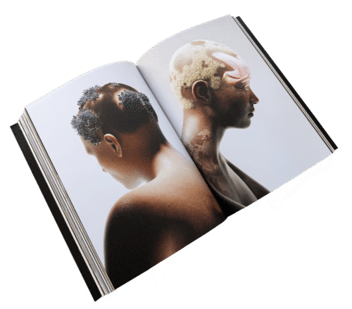 Publikation tressless 1